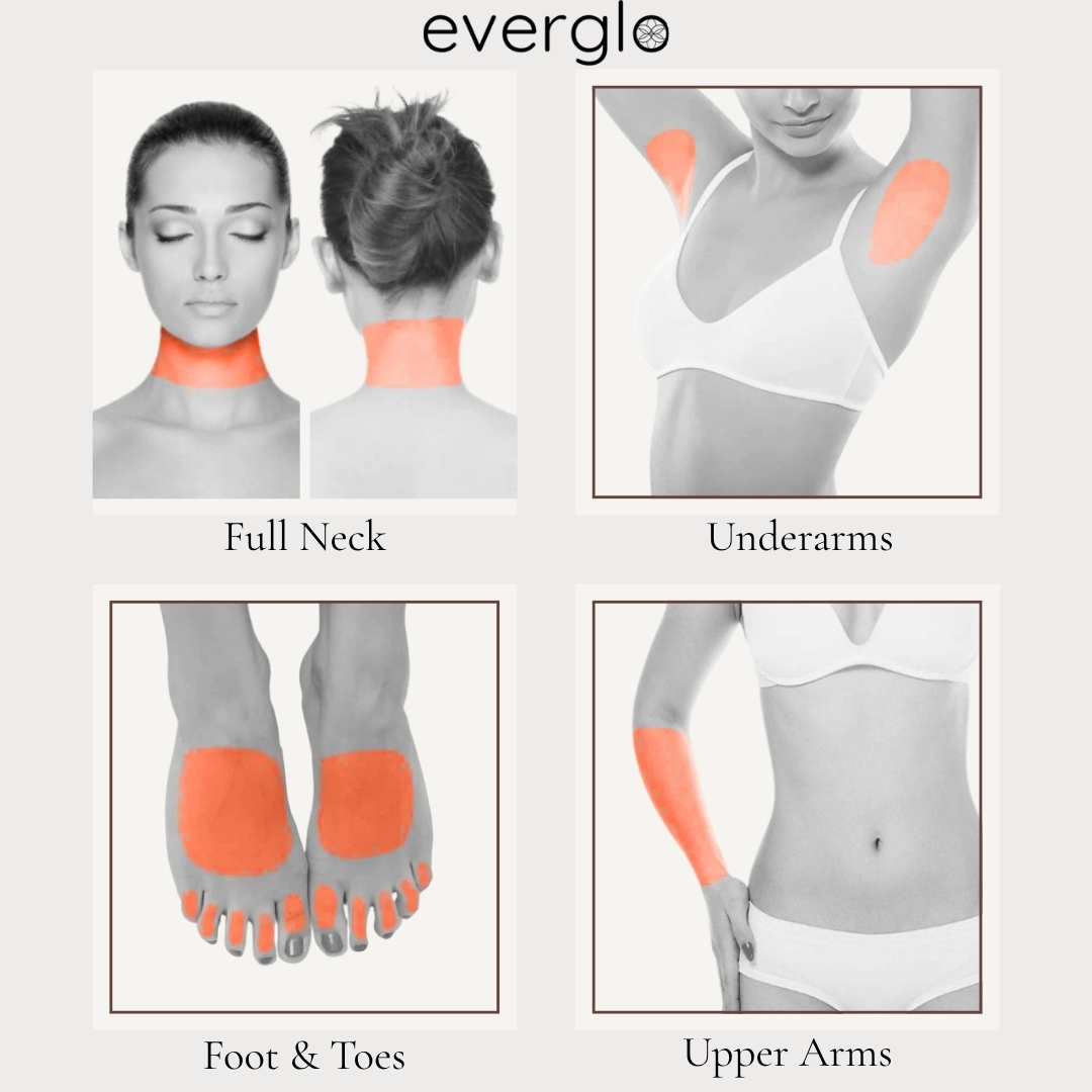 Laser Hair Removal - Small Part